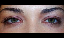 Eye Lash Extensions After