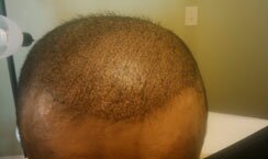 Hair Simulation Before