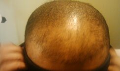 Hair Simulation Before