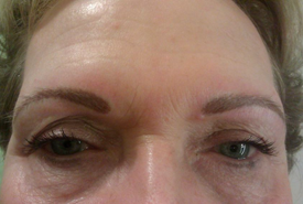 Eye Lash Extensions After