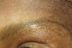 Eye Lash Extensions Before