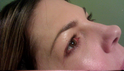 Micropicmintation After