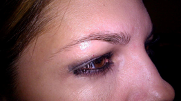 Micropicmintation After