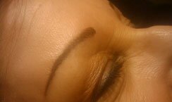 Micropicmintation Before