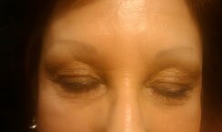 Micropicmintation Before