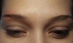 Micropicmintation After