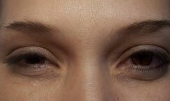 Micropicmintation After